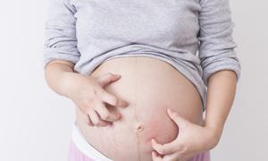 孕期营养食谱