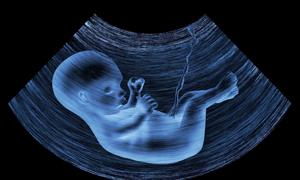电脑辐射对胎儿的影响