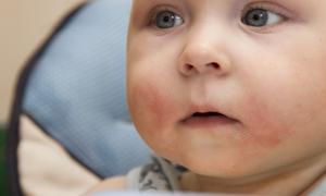 什么是新生儿脑缺氧