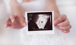 胎儿双顶径小于孕周