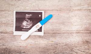 孕妇肾结石对宝宝有影响吗